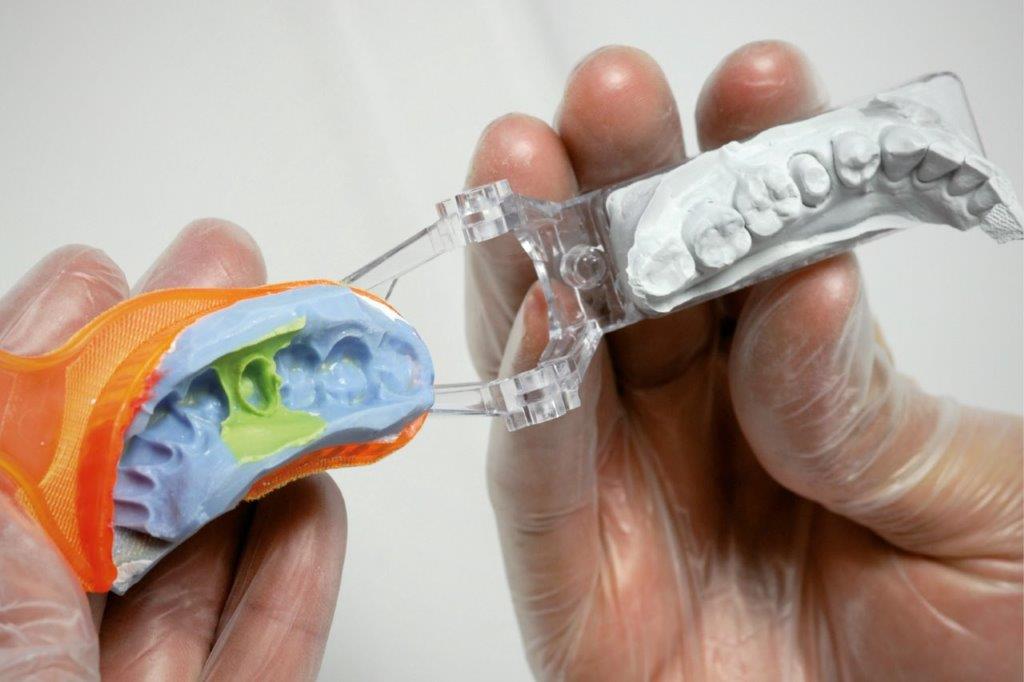 The dual arch impression taking