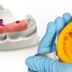Clasificación de los materiales para impresiones dentales elásticos y rígidos