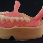 Analog and digital workflow in full dentures: the main differences