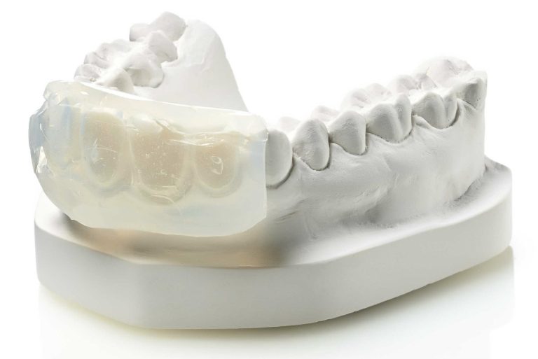 Protesi fissa con compositi e silicone per addizione Elite Transparent