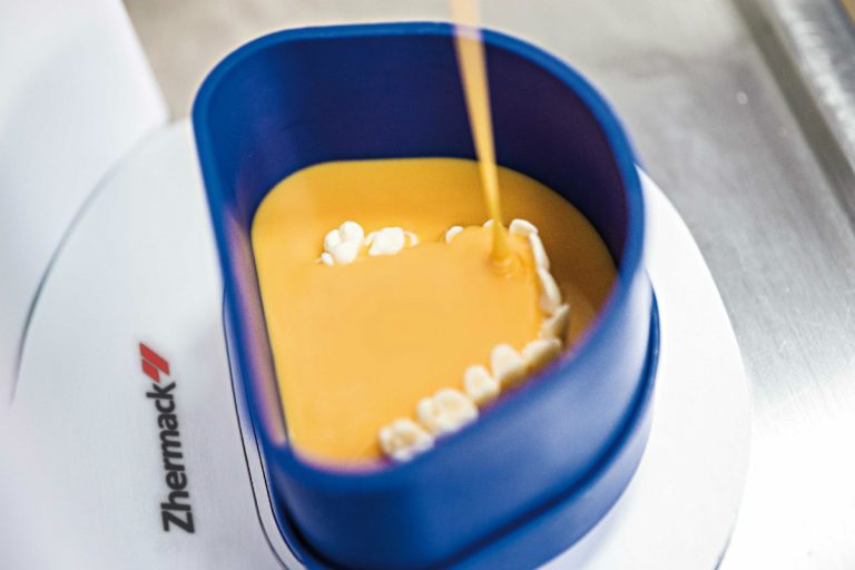 Siliconi da duplicazione o idrocolloidi? La sfida per la precisione