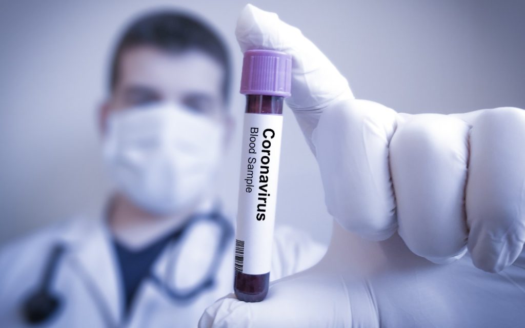 coronavirus-dental