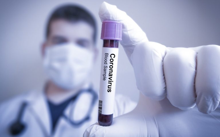 Le misure di prevenzione per evitare il contagio da Coronavirus