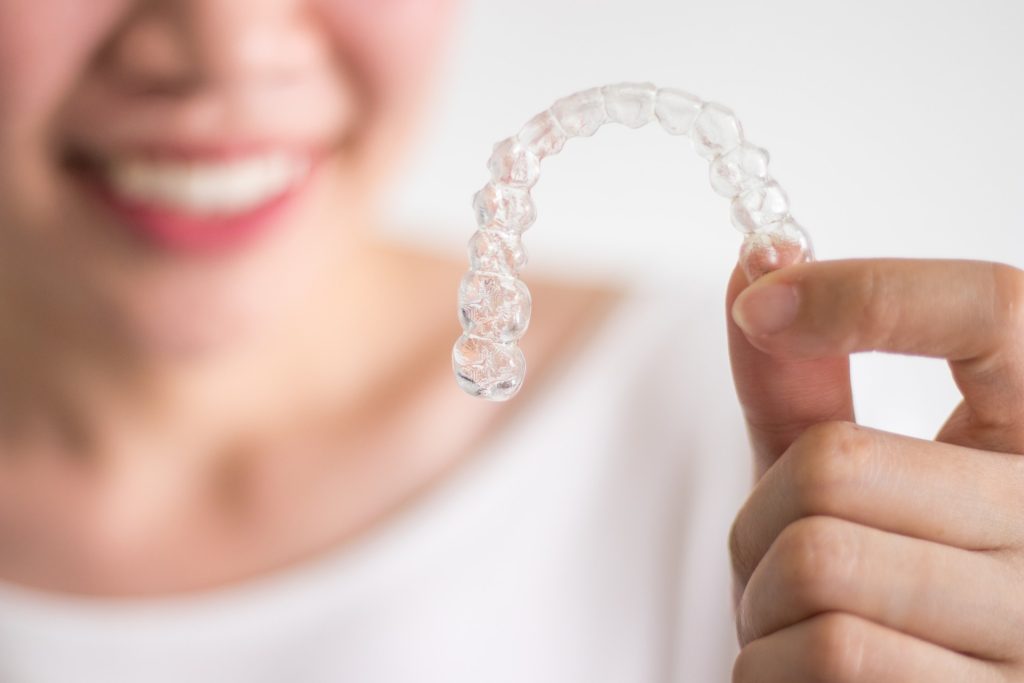 allineatori-impronta-silicone