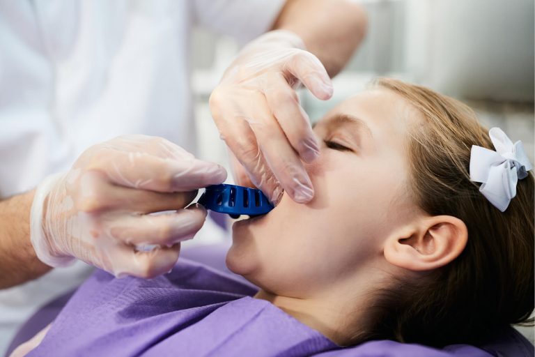La prise d’empreinte chez l’enfant