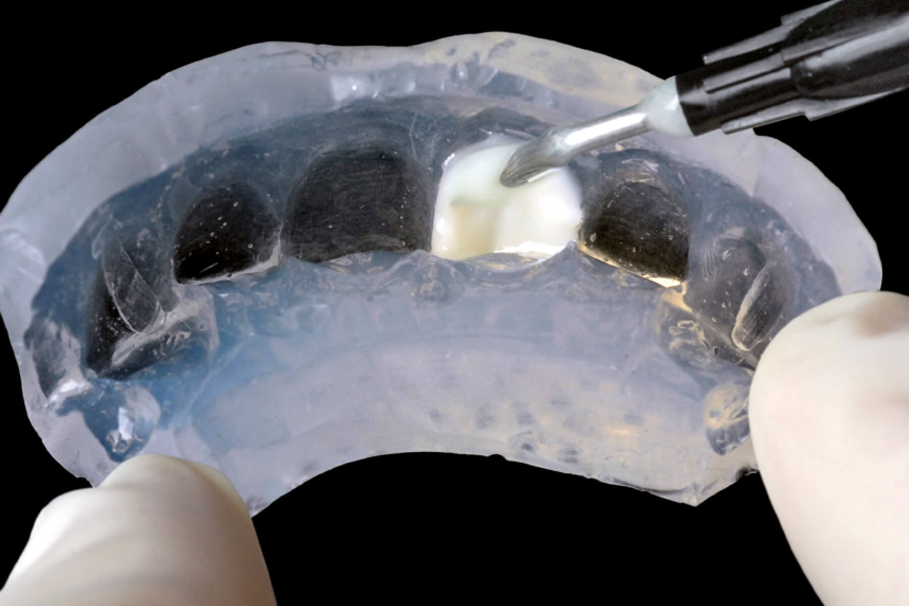 When to use a clear silicone: clinical applications