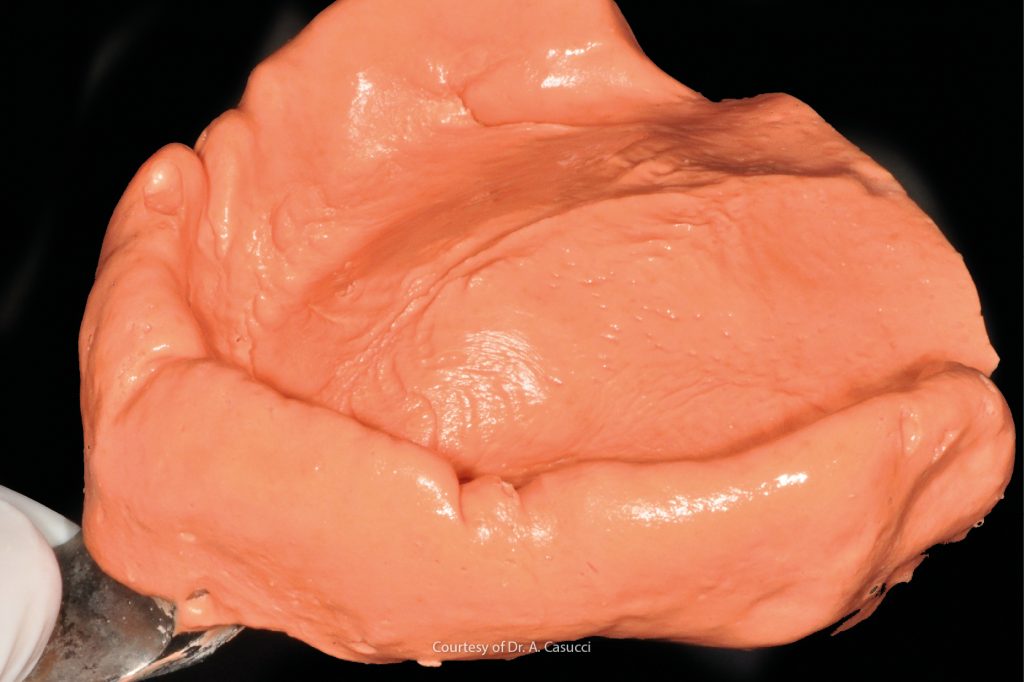 mobile prosthesis Neocolloid-Casucci