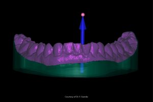 scansionabilità impronta dentale