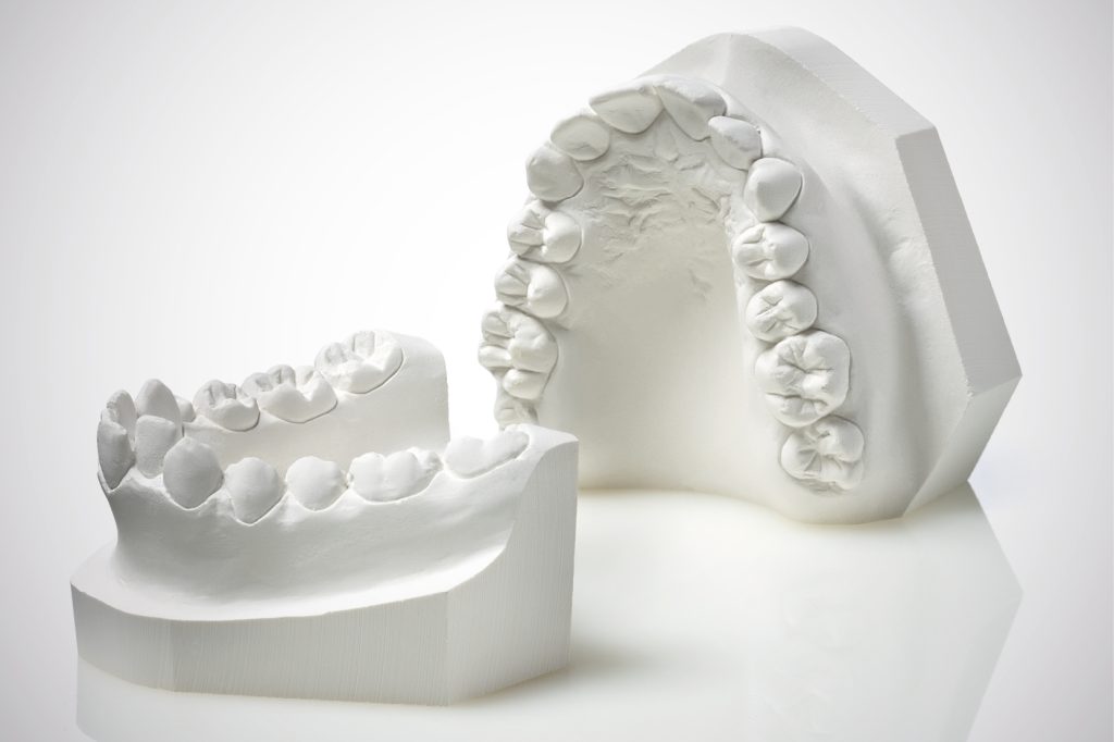 materiali gessosi odontoiatria