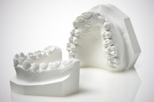 materiali gessosi odontoiatria