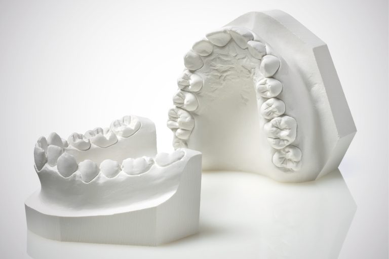 Impiego dei materiali gessosi in Odontoiatria