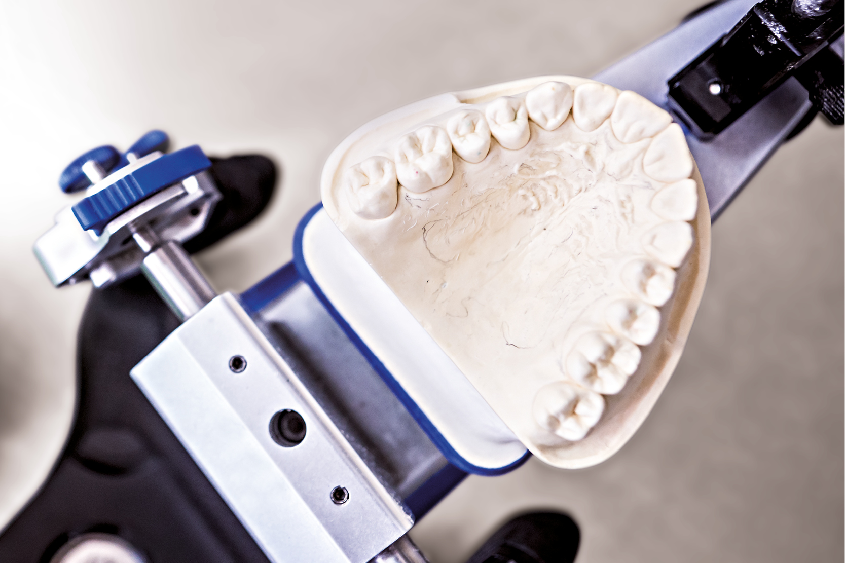 Caractéristiques idéales des modèles en plâtre dans la technologie dentaire