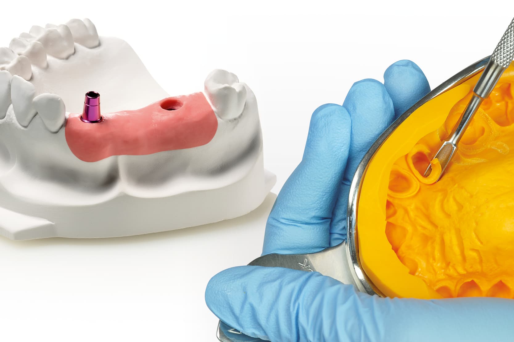 Elastic and rigid impression materials classification