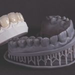 Gypsum models vs 3D models that can be printed: characteristics and accuracy factors compared