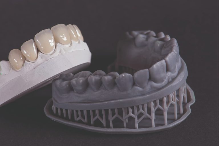 Modelli in gesso vs Modelli 3D stampabili: caratteristiche e fattori di accuratezza a confronto