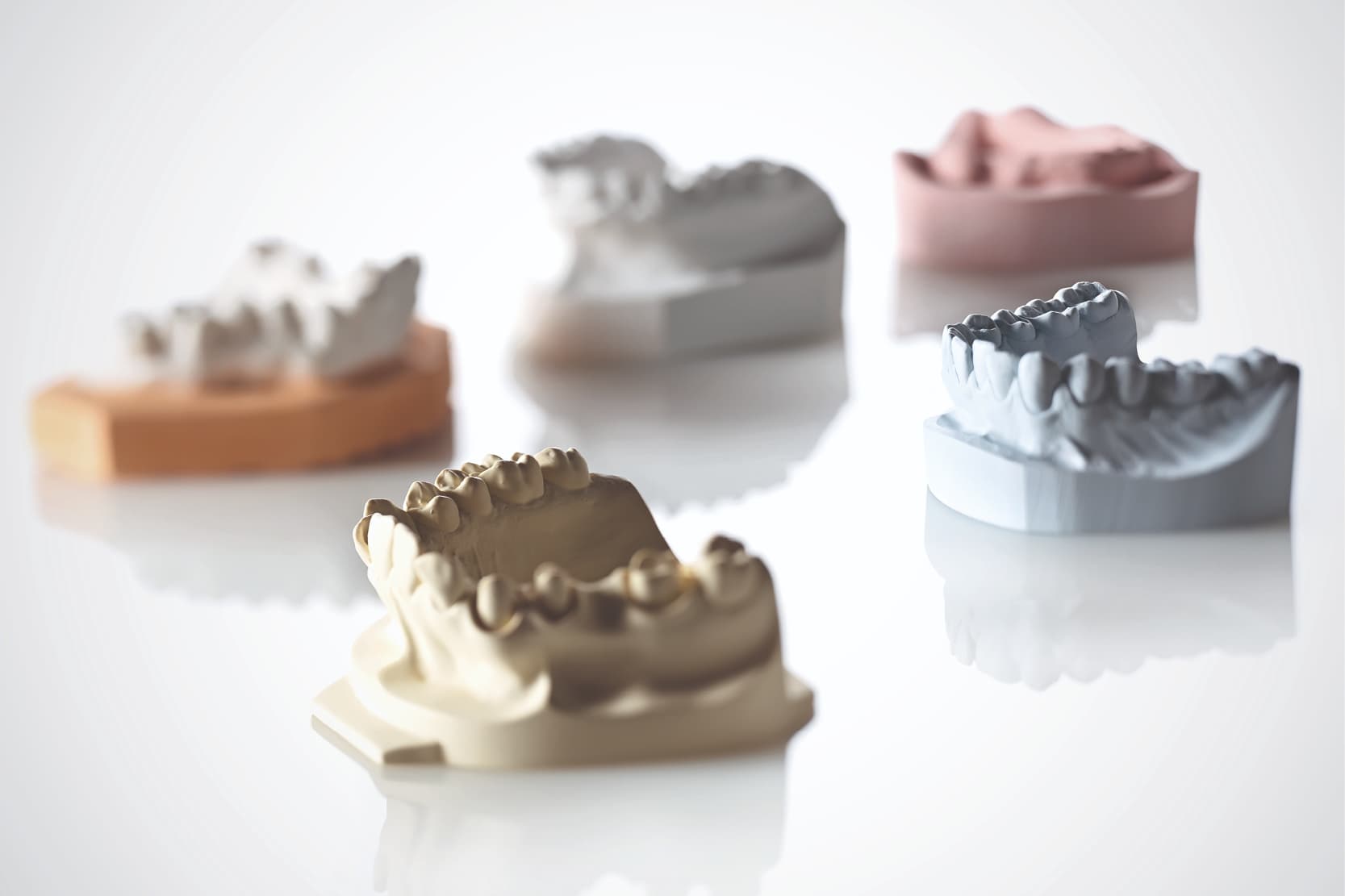 Modèles orthodontiques: méthodes de fabrication et utilisation de matériaux  à base de plâtre/résine