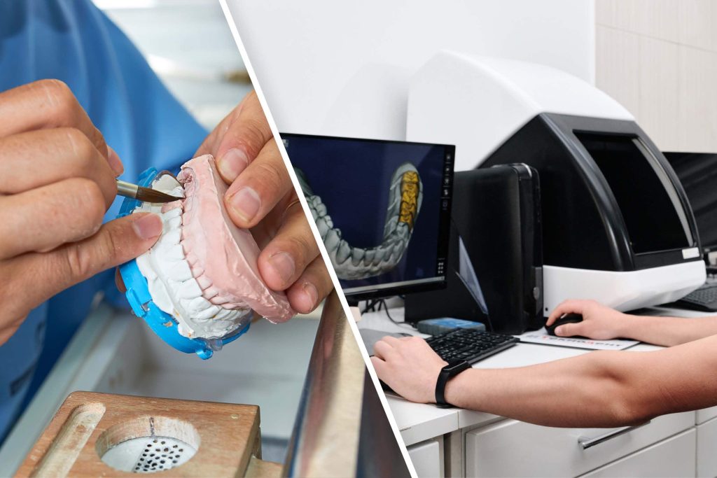 Il laboratorio digitale e odontotecnici di nuova generazione: confronto tra passato e presente.
