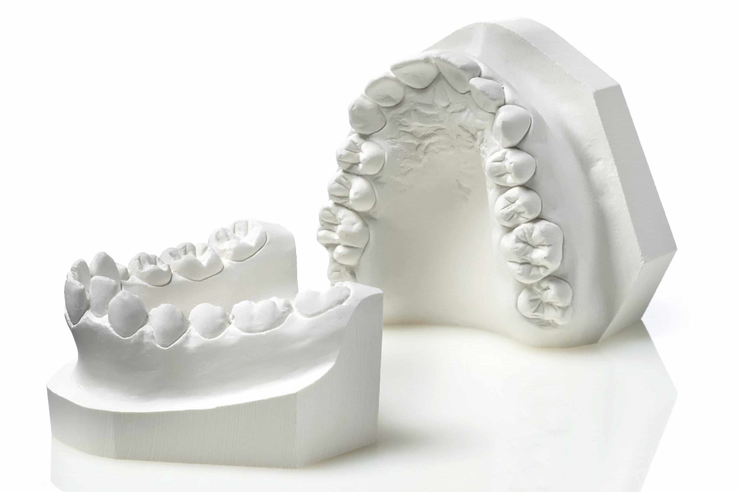 Modèle de dents dentaires, modèles d'étude de comparaison de caries, modèle  de dents d'éducation d'anatomie dentaire de dentiste pour les études et la