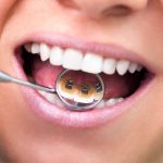Ortodonzia linguale: materiali e procedimenti clinici.