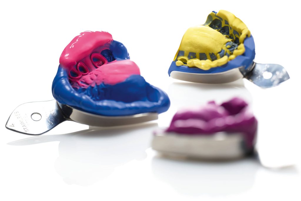 Gli errori da evitare per una corretta presa d'impronta dentale.