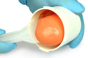 Abformtechniken für Patienten mit zahnlosem Kiefer Tecniche per la presa d’impronta su paziente edentulo.