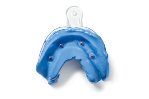 si cliniche e tecniche di realizzazione di protesi fisse su impianti multipli.