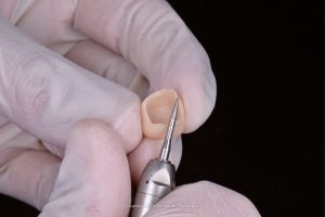Provvisorio in pre-limatura: la tecnica diretta-indiretta.