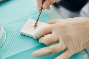 Cementi dentali per protesi: proprietà e caratteristiche ideali Cementi dentali per protesi: proprietà e caratteristiche ideali