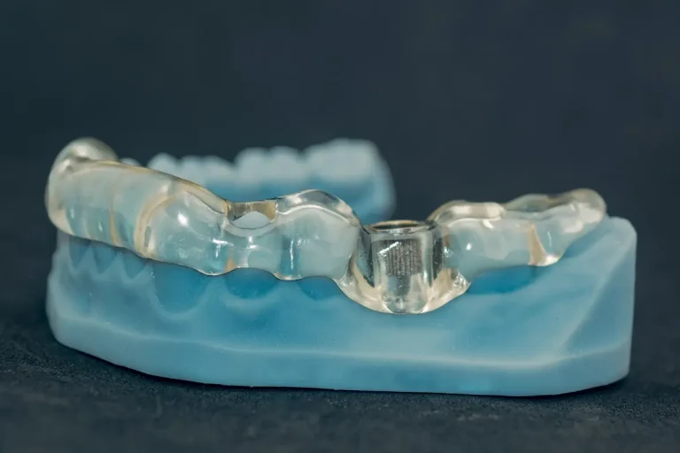 Chirurgia guidata implantare: applicazioni, vantaggi e svantaggi