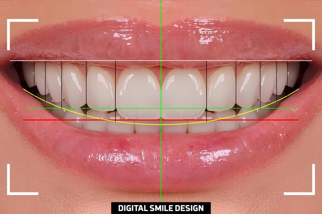 Il digitale in odontoiatria e nell’estetica dentale: vantaggi e limiti.