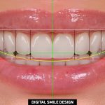 Il digitale in odontoiatria e nell’estetica dentale: vantaggi e limiti.