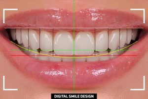 Il digitale in odontoiatria e nell’estetica dentale: vantaggi e limiti.