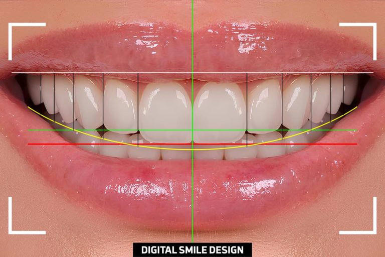 Il digitale in odontoiatria e nell’estetica dentale: vantaggi e limiti