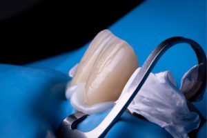 Cemento dentale per protesi