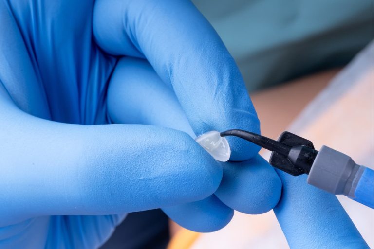 Cementi resinosi: cosa sono, tipologie e applicazioni cliniche