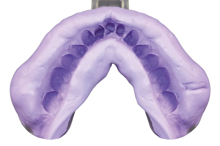 I sostituti dell’alginato: vantaggi nell’utilizzo