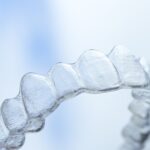 I limiti dell’ortodonzia con allineatori dentali I limiti dell'ortodonzia con allineatori
