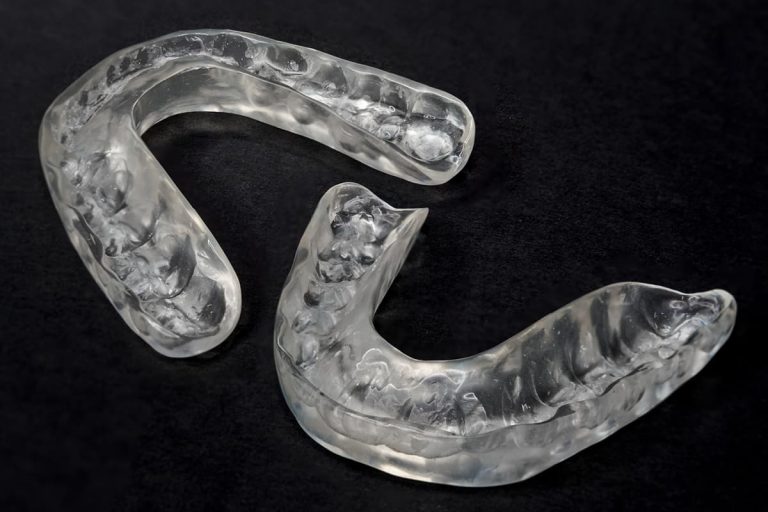 A cosa serve il bite dentale: tipologie e utilizzi