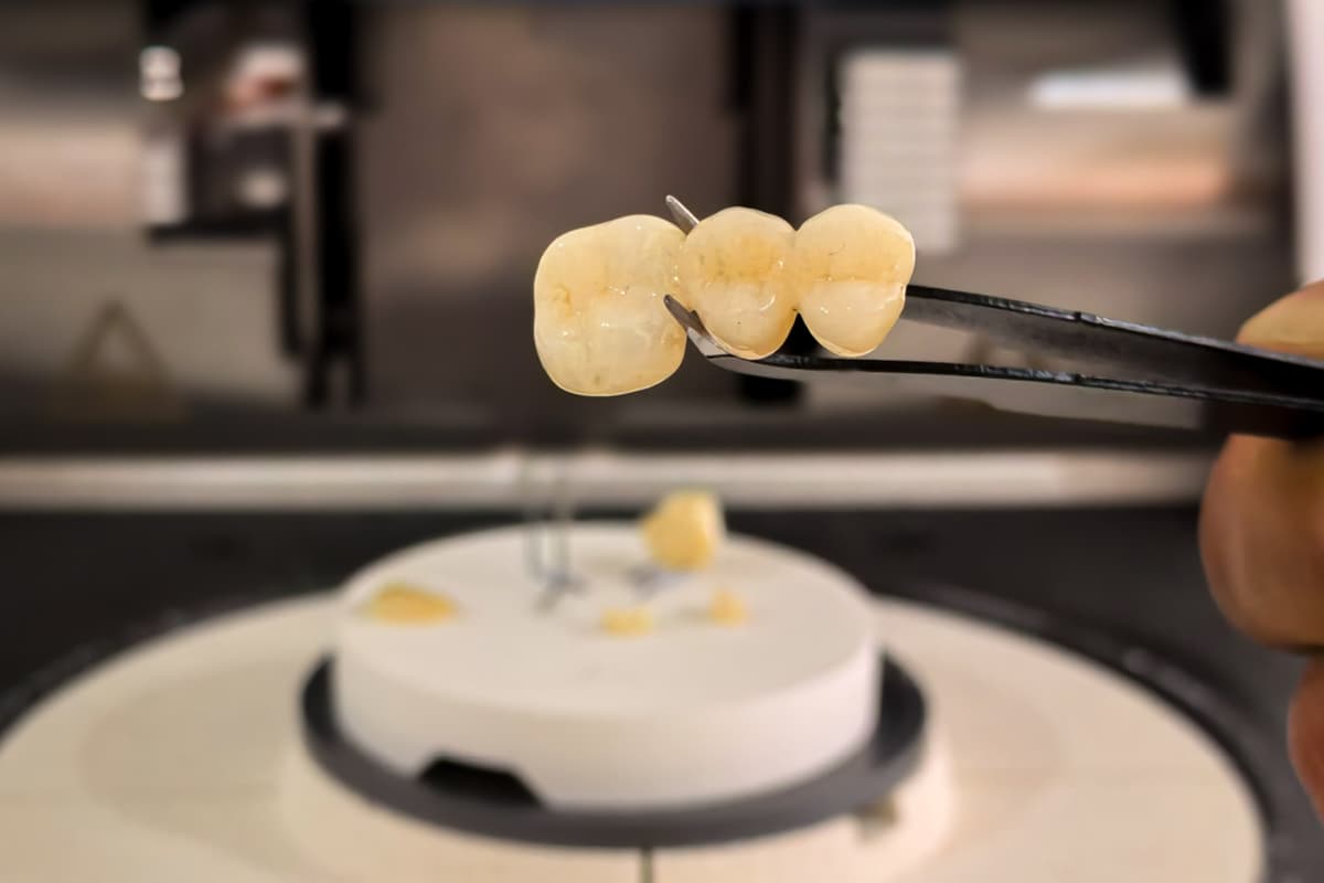 La zirconia dentale come materiale da restauro